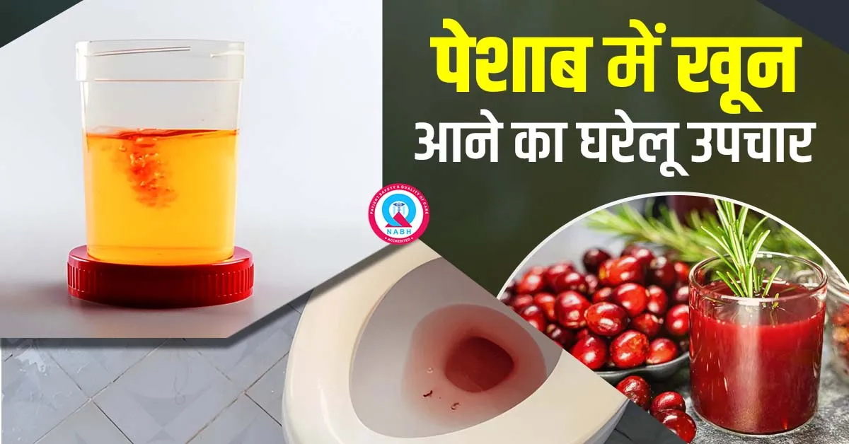 पेशाब में खून आने का घरेलू उपचार